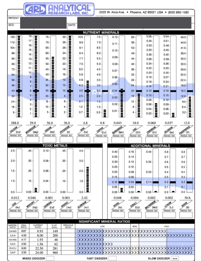 HTMA Hair Analysis